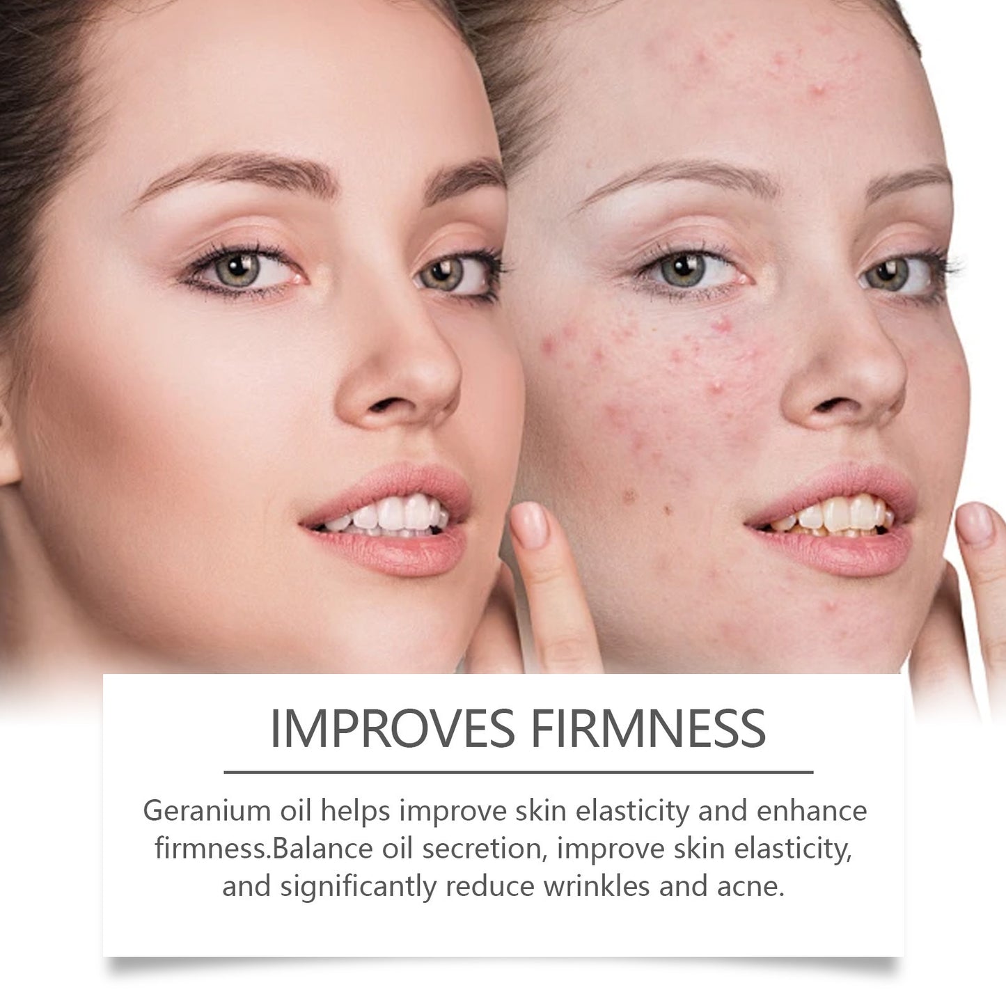 Facial Acne Skin Retinol Oil - ILLUMEW