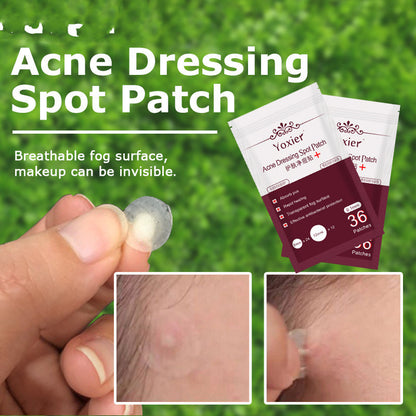 Skin Care Tools Acne Dressing Spot Patch - ILLUMEW