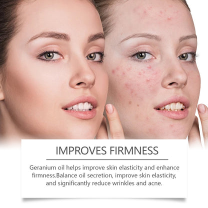Facial Acne Skin Retinol Oil - ILLUMEW